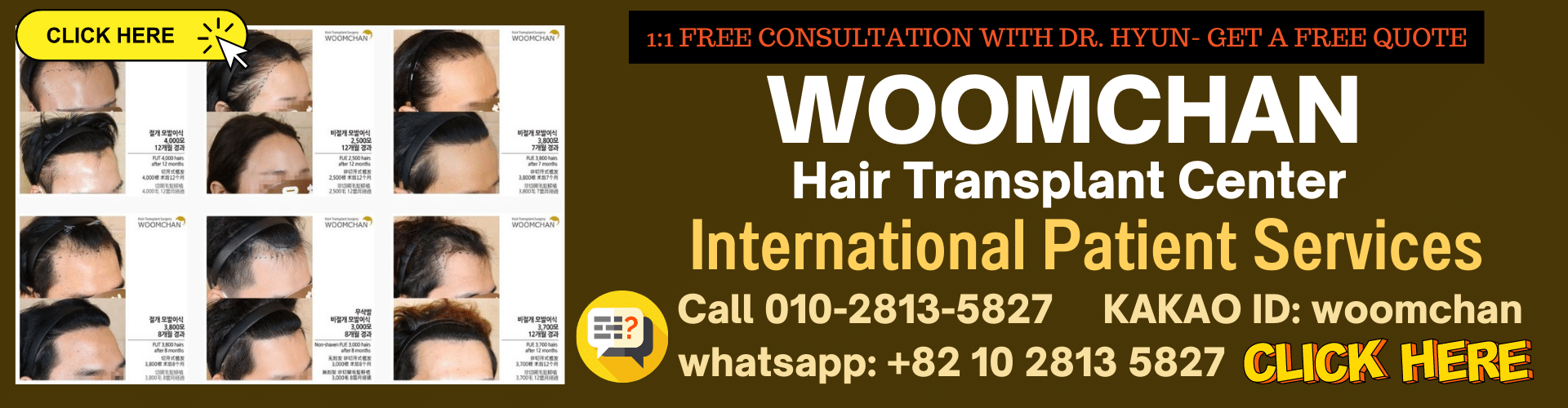 Best 10 Hair Transplant Clinics in Seoul, Korea